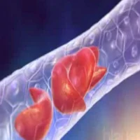 Aplastik Anemi Nedir?