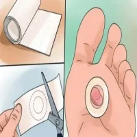 Ayakta Su Toplaması